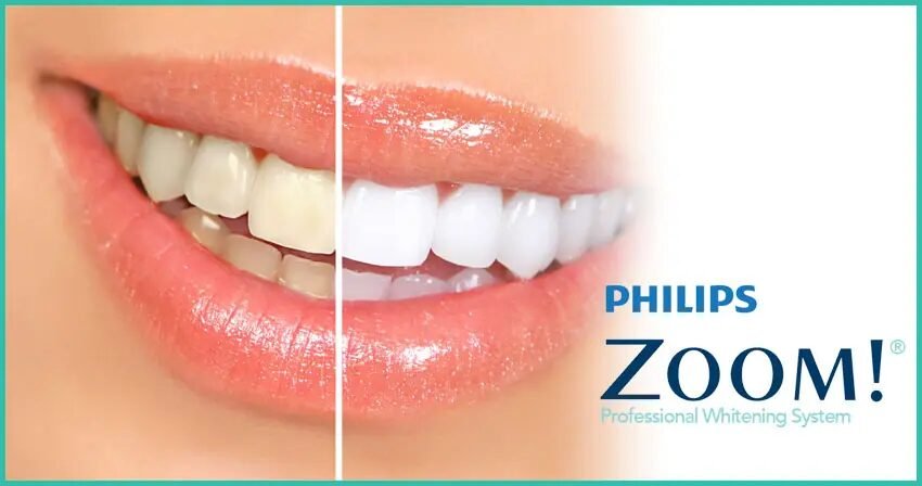 philips zoom whitening